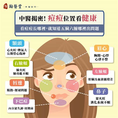 痘痘 位置|青春痘、下巴痘痘長這個位置代表什麼意思？先弄懂長。